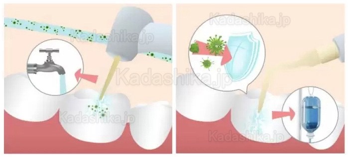 Refine MaxSurgery 歯科用超音波骨切削器 ピエゾボーン手術システム